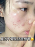 CLOUK氨基酸洗面奶男女士美白淡斑提亮膚色控油清潔毛孔祛痘黑頭潔面乳 【告別黃黑皮】美白潔面乳520ml*1 曬單實拍圖