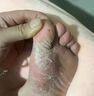 達克寧腳氣藥止癢脫皮爛腳丫真菌感染治腳氣達克寧硝酸咪康唑乳膏腳臭腳氣藥止癢真菌感染皮膚用藥 非處方藥 2盒【硝酸咪康唑乳膏】癢的受不了 老是摳腳 達克寧腳氣藥止癢脫皮爛腳丫真菌感染治腳氣 曬單實拍圖
