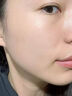 維特絲壬二酸祛痘藥膏煙酰胺凝膠去痘痘粉刺閉口男女水楊酸收毛孔青少年 曬單實(shí)拍圖