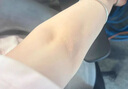 膚妍胳膊肘黑色素沉淀去除肘部去黑棘皮膏富含煙酰胺美白膏一抹就白 5霜+5精華【全身都能用】用半年 曬單實(shí)拍圖