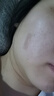 美皮護Mepiform疤痕貼剖腹產(chǎn)甲狀術(shù)后淡疤撫痕兒童疤痕修護疤痕貼 【星品款-醫美術(shù)后】2.5cm×10cm 曬單實(shí)拍圖