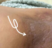 皇元妙醫(yī)股蘚癬膏大腿內(nèi)側(cè)真菌感染腹股溝股癬膏瘙癢藥紅疹越抓越癢噴霧劑 20g 5盒 【好后不犯】買3發(fā)5 曬單實拍圖