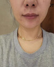 OHBT水楊酸祛痘面膜10片祛痘印修復(fù)痘坑毛孔收縮補水金榜第1名女男士 曬單實拍圖