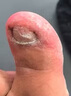 北京同仁堂灰指甲泡腳藥包真菌感染甲床分層增厚損傷指甲壞甲殺菌腳臭足浴包 單盒【體驗裝 30包/盒】 曬單實(shí)拍圖