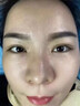 云南本草顆粒清肌膏 可搭正品眼周脂肪粒眼霜草本植物顆粒清肌精華液眼部脂肪粒油脂粒黑眼圈男女通用 兩支特惠裝+棉簽 曬單實拍圖