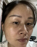 焦博士日本377祛斑霜美白淡化老年黃褐雀斑黑色素熊果苷乳膏去曬男女士 曬單實(shí)拍圖