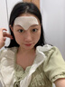 Redact澳洲抬頭紋川字紋貼去除神器額頭皺紋貼去除男女抗皺緊致衰老專(zhuān)用 曬單實(shí)拍圖