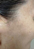 碧素堂祛斑霜美白淡化老年黃褐雀斑去斑去黑色素男士老年斑臉部手背祛斑 強(qiáng)效特效霜:一盒裝【醫(yī)用正品】 專用霜去老人斑淡化淡斑醫(yī)用正品 曬單實(shí)拍圖