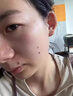 鑫博士點痣膏藥水去痣點疣無痕臉部不留疤黑痣扁平疣瘊男女士專用修復(fù)液 曬單實拍圖