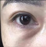 玖美堂眼袋去除神器男士專(zhuān)用眼霜膜眼袋提拉緊致抗皺淡化黑眼圈淡化細紋 類(lèi)蛇毒眼霜【單盒體驗裝】 曬單實(shí)拍圖
