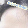 Redact澳洲抬頭紋川字紋貼去除神器額頭皺紋貼去除男女抗皺緊致衰老專用 曬單實(shí)拍圖