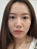 焦博士日本眼膜眼袋貼提拉緊致抗皺淡化細(xì)紋黑眼圈去眼貼膜眼袋眼紋專用 曬單實(shí)拍圖