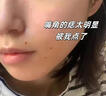 FLYMAN點(diǎn)痣膏水疤痕修復(fù)去痣點(diǎn)痣膏點(diǎn)疣水醫(yī)用專(zhuān)用膏藥官方正品祛痣膏 套裝一:【點(diǎn)痣+修復(fù)】一盒 痣準(zhǔn)掉 祛斑潤(rùn)膚美容院專(zhuān)用不留疤不留坑 曬單實(shí)拍圖