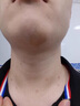 DRVIALY扁平疣專(zhuān)用疣體脫落膏去疣瘊子特藥膏絲狀疣型瘊靈去除脖子小肉粒 3盒裝【頑固疣體-100%特效果】 曬單實(shí)拍圖