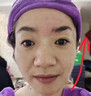 第三代優(yōu)仙眼部抗衰大師面部儀器去眼袋淡化細(xì)紋黑眼圈美容院專用 三代眼部大師 曬單實(shí)拍圖
