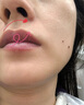 DR.CFUN德國醫用級點(diǎn)痣祛去痣點(diǎn)痣膏官方正品無(wú)痕臉部黑痣雀斑點(diǎn)痣疣藥水 【德國專(zhuān)研】醫用級點(diǎn)痣 | 適用于各種痣痦 曬單實(shí)拍圖