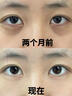 Losoki瑞士進(jìn)口眼霜淡化細(xì)紋提拉緊致黑眼圈去眼袋抗皺抗衰老護(hù)膚品禮物 曬單實拍圖