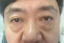 仙宸眼貼膜淡化細紋去眼袋黑眼圈提拉緊致消除重度眼袋專(zhuān)用女去除神器 一盒【眼袋貼祛除神器】 眼霜去大眼袋嚴重中老年專(zhuān)用男士 曬單實(shí)拍圖