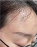 清熱暗瘡丸祛痘痘粉刺痘印醫用痤瘡中藥去青春痘紅腫硬疙瘩痘印消炎膿皰去痘印青少年痤瘡專(zhuān)用藥【視覺(jué)特效】 1盒【國藥正品】標準裝 曬單實(shí)拍圖
