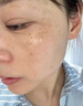 SKISGEM德國進(jìn)口除螨蟲祛痘痘印洗面奶去黑頭收毛孔粉刺氨基酸控油男女士 【洗凈黑頭油痘】洗面奶120ml 曬單實拍圖