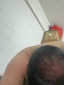 【第二代米諾地爾】蔓迪生發(fā)泡沫劑60g*2（倍速生發(fā) 溫和不起痘）防脫育發(fā)增發(fā)液5%濃度酊搽劑 曬單實拍圖