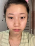 南京同仁堂祛痘膏去痘痘和痘印痘坑修復(fù)男女士改善粉刺閉口30g 曬單實(shí)拍圖
