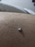 CNDK去脖子肉揪頸部臉部手足腋下云南本草絲狀猴植物草本精華男女外用 今日活動(dòng)【強效款-2盒療程裝】 曬單實(shí)拍圖