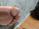 DR.SCT雞眼貼雞眼膏去除祛根去肉刺刺猴無(wú)痛脫落雞眼連根拔跖疣專用非藥 曬單實(shí)拍圖