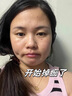 濟(jì)苑堂去痣點(diǎn)痣膏祛痣點(diǎn)疣正品專(zhuān)用無(wú)痛無(wú)痕可搭醫(yī)用藥水用藥臉部不留疤 曬單實(shí)拍圖