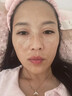 YYTISS377祛斑霜美白淡化老年黃褐雀斑黑色素曬淡斑精華醫(yī)I用煙酰胺凝膠 曬單實拍圖