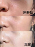 Newliann醫(yī)用重組三型人源化膠原蛋白外用人表皮生長因子凝膠皮膚疤痕修復(fù) 曬單實拍圖
