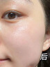 Newliann醫(yī)用重組三型人源化膠原蛋白乳液修復(fù)敷料凝膠人表皮生長(zhǎng)因子面霜 曬單實(shí)拍圖