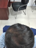 Tinstar云鬢生發(fā)膠囊密發(fā)科技內服固發(fā)護發(fā)防脫發(fā)修護靶向毛囊生物素養發(fā) 四瓶周期裝【中度發(fā)量失衡推薦/買(mǎi)3贈1】 曬單實(shí)拍圖