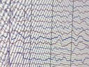 【套裝2本】臨床腦電圖培訓教程+臨床腦電圖學(xué) 第2版第二版 臨床腦電圖學(xué) 劉曉燕 實(shí)用腦電圖現象臨床腦電圖學(xué)圖譜 腦電圖書(shū)籍 曬單實(shí)拍圖