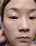 汗管瘤眼部去除油脂粒祛眼部周圍脂肪粒專用眼霜眼油脂粒涂抹藥膏 單盒裝 曬單實(shí)拍圖