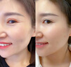 半桃黃芪抗皺眼霜30g淡化細紋眼紋提拉緊致黑眼圈眼袋男女士老國貨 曬單實拍圖