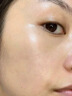 醫用精華液械字號收縮毛孔粗大修復細致去黑頭粉刺閉口男士女士祛痘印黑色素沉淀控油淡化痘印痘坑透明質(zhì)酸鈉 曬單實(shí)拍圖