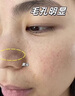 醫用精華液械字號收縮毛孔粗大修復細致去黑頭粉刺閉口男士女士祛痘印黑色素沉淀控油淡化痘印痘坑透明質(zhì)酸鈉 曬單實(shí)拍圖