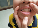 奧樂(lè )V6-12歲潔白系列小孩學(xué)生兒童護牙劑 換牙期蟲(chóng)牙牙黃黑斑 兒童牙膏 【專(zhuān)業(yè)潔白】50克6支裝，送4件禮 曬單實(shí)拍圖