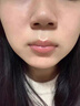 維特絲愈創(chuàng  )木祛痘控油修護保濕乳液淡化痘印去痘痘收縮毛孔男女士護膚品 曬單實(shí)拍圖