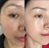 OHBT黃芪面膜10片抗皺緊致抗衰老補(bǔ)水熬夜美白淡斑女男士金榜第1名 曬單實(shí)拍圖