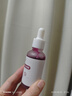 咔詩(shī)迪曼2%水楊酸果酸祛痘精華液30ml痘印痘坑修復收縮毛孔祛痘護膚品 曬單實(shí)拍圖