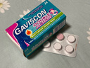 【英國進(jìn)口】Gaviscon嘉胃斯康中和胃酸咀嚼片24粒 消化不良反酸燒心胃食管反流 進(jìn)口胃疼痛胃炎藥腸胃 胃脹 曬單實(shí)拍圖
