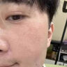 阿達帕林凝膠醫(yī)用收縮毛孔粗大修復細致祛痘印修復淡化痘印痘坑修復藥膏祛痘消炎痤瘡?？破つw用藥祛痘印黑頭 3盒【堅持一個月 毛孔再見】東京直營官方旗艦店 曬單實拍圖