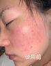 Newliann醫用重組三型人源化膠原蛋白乳液修復敷料凝膠人表皮生長(cháng)因子面霜 曬單實(shí)拍圖