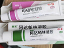 麗芙阿達(dá)帕林凝膠16g+甲硝唑銼凝膠20g去黑頭修復(fù)毛孔收縮毛孔粗大祛痘印修復(fù)淡化痘印痘坑修復(fù)藥膏 曬單實(shí)拍圖