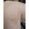 香港大藥房爐甘石止癢香皂全身皮膚瘙癢皮炎濕疹真菌感染爐甘石抑菌止癢膏藥 單盒裝【一洗止癢】 爐甘石藥皂去痱子外用沐浴露 曬單實(shí)拍圖