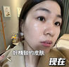 焦博士日本377祛斑霜美白淡化老年黃褐雀斑黑色素熊果苷乳膏去曬男女士 曬單實(shí)拍圖