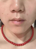 EDRI法令紋去消除神器睡覺(jué)專(zhuān)用提拉緊致抗皺去法令紋嘴角皺紋八字紋貼 曬單實(shí)拍圖