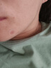 久卜制藥痘痘貼日夜兩用消炎吸膿祛痘淡痘印輕薄隱形親膚上妝遮瑕貼 曬單實拍圖